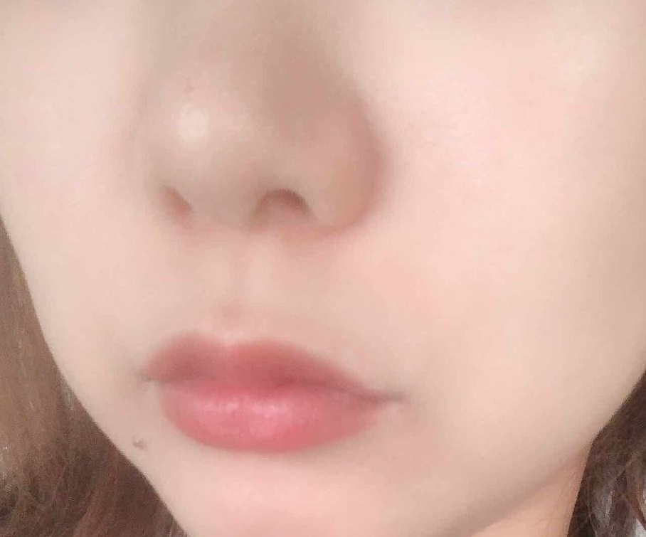 白萄しずくを使ってみて、実際に毛穴の開きや乾燥肌、肌荒れが治った人の写真