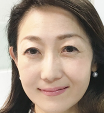 まゆさん(20代女性)